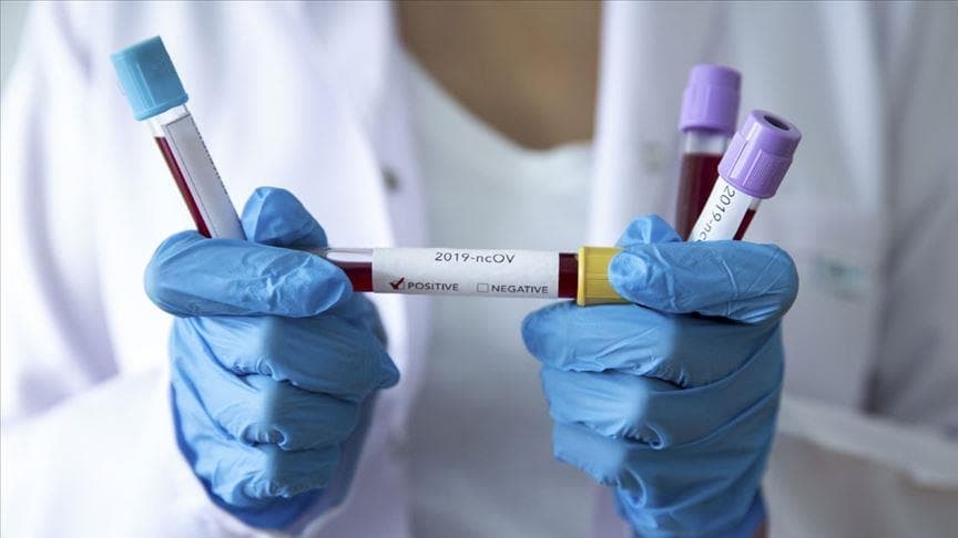 Чехия перестала быть одной из самых худших стран по ситуации с коронавирусом